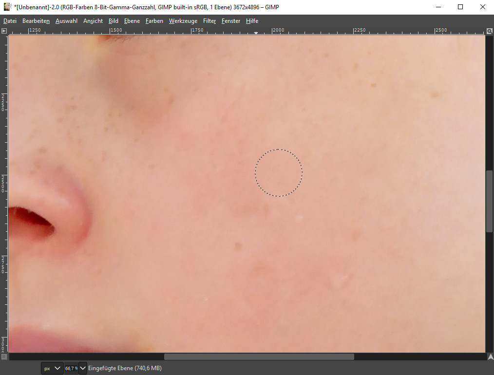 GIMP Leberflecken entfernt Zoom